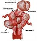 disfunziona ovarica