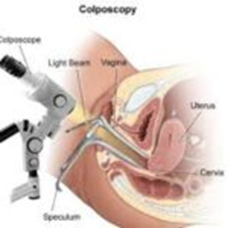 colposcopia