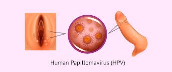 RAPPORTI SESSUALI E HPV