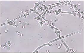 CANDIDA KRUSEI